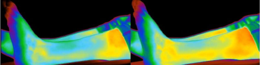 Thermografie Symposium Quantum-Touch